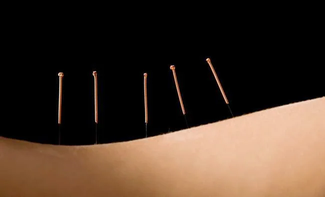 Ladera Acupuncture Clinic — Acupuncture in Mission Viejo, CA