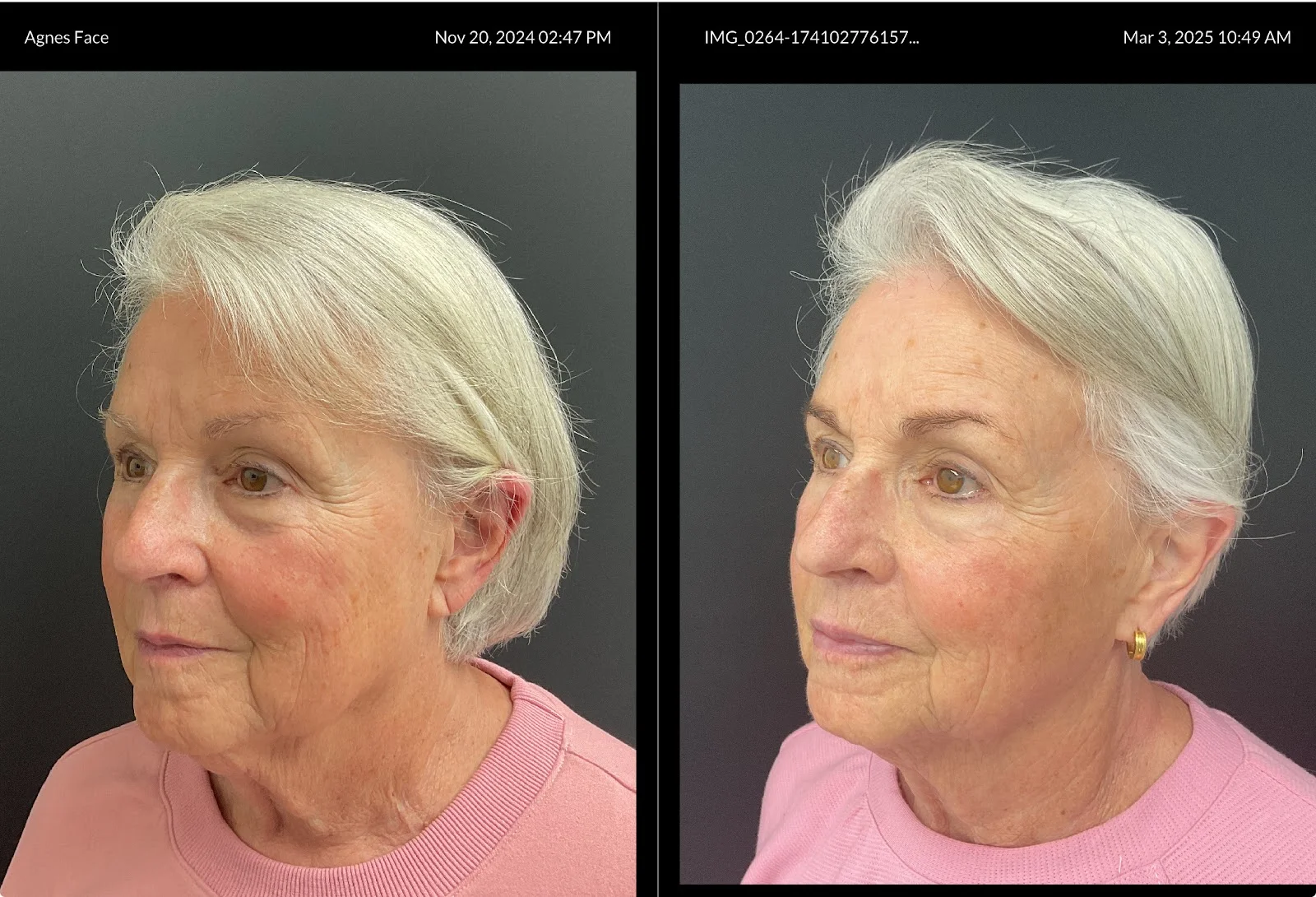 OC Weight Loss & Med Spa — Med Spa & Wellness in Mission Viejo, CA