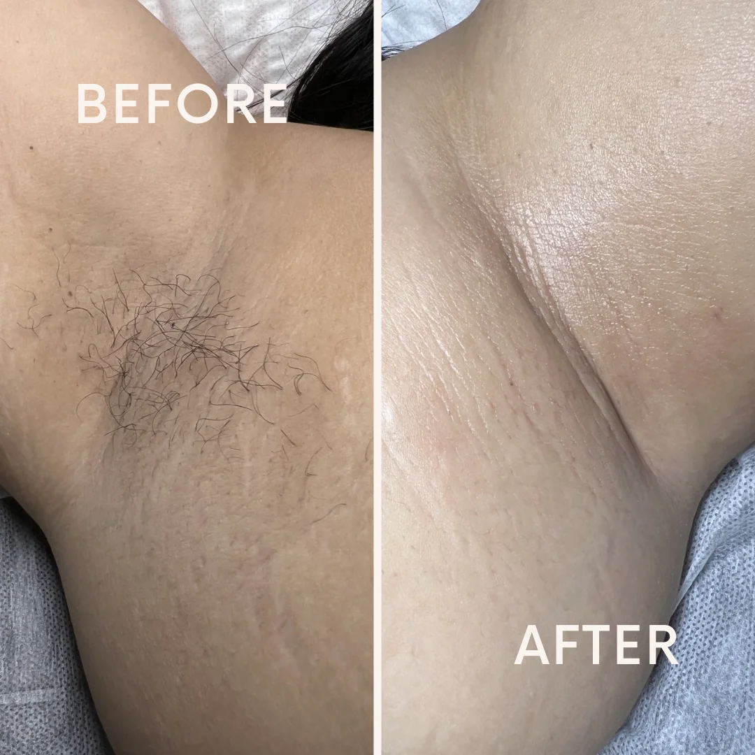 Ivesthetics — Beauty & Personal Care in Mission Viejo, CA